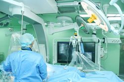 Phẫu thuật thành công người bị nhồi máu cơ tim cấp