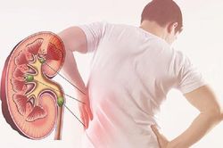 Người bị bệnh thận kiêng gì để tốt cho sức khỏe?