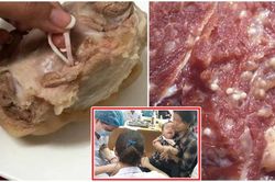 Bệnh sán lợn là gì? Triệu chứng nhiễm sán lợn như thế nào?