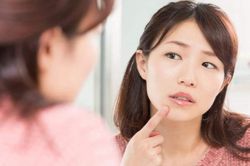 5 cách trị mụn ẩn trên trán tại nhà giúp nhân tự trồi lên không cần nặn