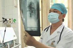 Chủ động chống bệnh lao như chống dịch COVID-19