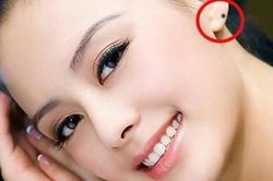 Có nốt ruồi ở vị trí này, chủ nhân nhất định giàu có sau tuổi 30