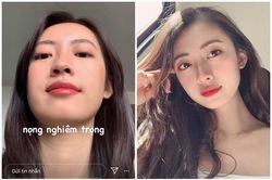 Khoe nọng cằm, bạn gái Rocker Nguyễn vẫn được khen hết lời