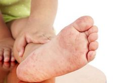 Bệnh tay chân miệng cấp độ 1 ở trẻ nhỏ: Biểu hiện, điều trị và phòng tránh