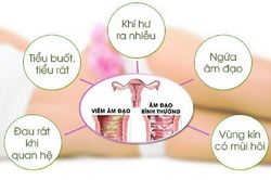 Viêm nhiễm phụ khoa, khi nào cần đi khám?