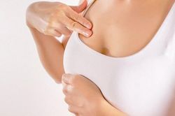 Lấy lại 'vòng một' cho chị em mất mô tuyến vú
