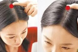 Cơ thể con người có 5 'công tắc' để mọc tóc, hãy bấm mỗi ngày để ngăn rụng tóc và tạm biệt hói đầu