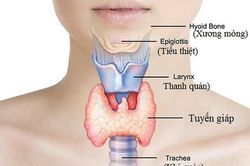 5 vấn đề sức khỏe nghiêm trọng thường gặp ở nữ giới