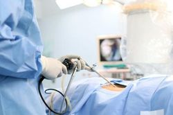Phẫu thuật nội soi ruột non bằng viên nang là gì?