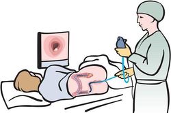 7 cách ngăn ngừa và phát hiện bệnh ung thư đại tràng