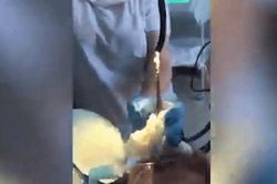 Hãi hùng cảnh lôi con rắn 1,2 m ra khỏi cổ họng người phụ nữ ở Nga