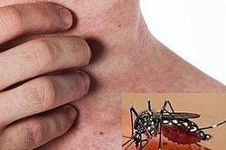 Từ trường hợp vừa tử vong do sốt xuất huyết ở Hà Nội, cần loại bỏ ngay những sai lầm 'chết người' nếu không muốn nguy hiểm