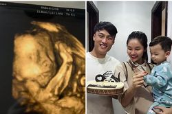 Mạc Hồng Quân khoe hình ảnh siêu âm của nhóc tì thứ 2 giống y hệt anh trai