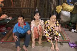 3 phận người trông vào 1 con mắt
