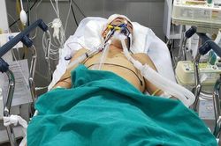Xót xa cảnh chồng vỡ khối u não, vợ mang thai không có tiền đi đẻ