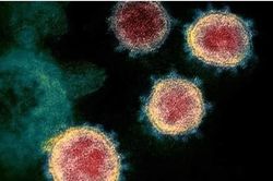 Phát hiện mới: Virus SARS-CoV-2 có thể xâm nhập vào não người