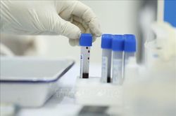 Xét nghiệm SARS-CoV-2 cho người có nhu cầu xuất cảnh