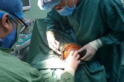 Bé trai bị chó nhà cắn toang nửa da đầu