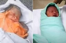Xót xa em bé sơ sinh bị bỏ rơi với con dao rỉ găm trên lưng, nhưng em đã sống sót kỳ diệu