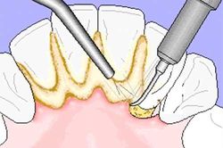 Răng ố vàng trở nên sạch bong sau vài giây nhờ loại rau thơm này
