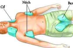 Cấp cứu thành công bệnh nhân hôn mê do say nắng
