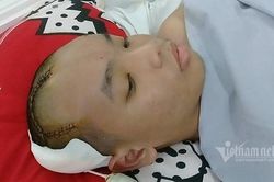 Cháu mồ côi học giỏi bị ung thư, tia hy vọng của bà ngoại vụt tắt