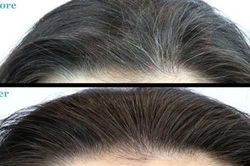 Trị tận gốc nỗi lo tóc bạc sớm nhờ 'thần dược' siêu rẻ này