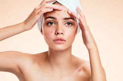 7 sai lầm khiến da bạn nổi mụn