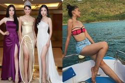 Đôi chân lệch tông của Tiểu Vy: Dấu tích của một mùa hè rực lửa