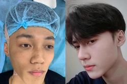 Chàng trai 19 tuổi chi 70 triệu đồng phẫu thuật thẩm mỹ