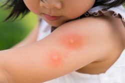 4 biện pháp phòng sốt xuất huyết lây lan trong gia đình khi có một người trong nhà mắc bệnh