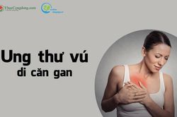 Ung thư vú di căn gan