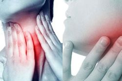 Ung thư vòm họng: Dấu hiệu nhận biết và các triệu chứng cần nhớ