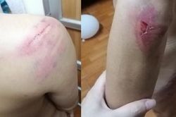 Con nợ bị những trận đòn tàn khốc vì vay lãi nặng