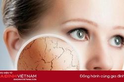 Những thực phẩm nên hạn chế ăn nếu không muốn lão hóa da