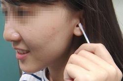 Sử dụng tăm bông ngoáy tai và mất thính lực, người phụ nữ được chẩn đoán mắc bệnh ung thư sau 3 tháng chịu đựng những cơn ngứa