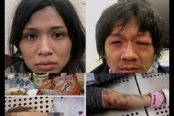 Chuẩn bị xét xử vụ bé 3 tuổi tử vong do cha dượng và mẹ ruột bạo hành