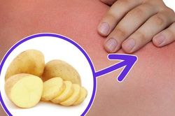 Những bài thuốc Đông y có sẵn trong bếp, trị bệnh cực tốt mà không tốn tiền