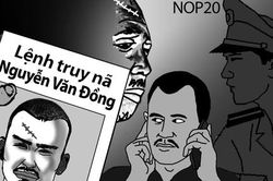 Vết sẹo trên trán