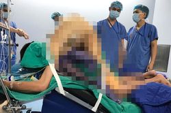 Người đàn ông đứng thẳng được sau 22 năm gù gập như tôm