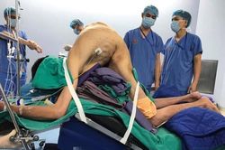 'Kéo' thẳng lưng cho người đàn ông mang hình dáng con tôm suốt 22 năm