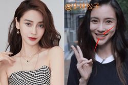 Angelababy bị nghi ngờ gặp biến chứng thẩm mỹ: Khuôn mặt cứng đơ, nhan sắc đáng báo động!