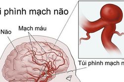 Bỏ qua cơn đau đầu, bé gái gục chết sau câu: 'Con không khỏe!'