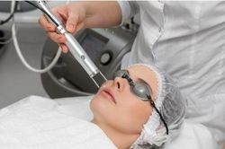 'Là' mặt bằng laser