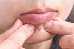 Những vật dụng cá nhân dễ gây mụn