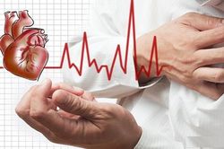 Coi bóng đè là mê tín, người phụ nữ suýt chết vì đột quỵ