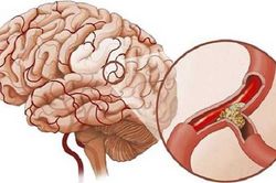 Làm việc đại kỵ này, gái trẻ suýt gục chết trong phòng tắm