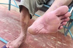 Những đôi chân ứa máu của người dân vùng lũ