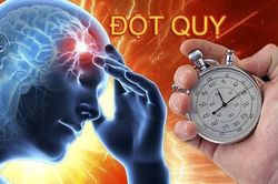 Những ai đã bị đột quỵ 1 lần, hãy làm điều này để tránh bị tái phát