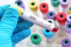 Người nhiễm HIV phải thông báo cho bạn tình trước khi quan hệ